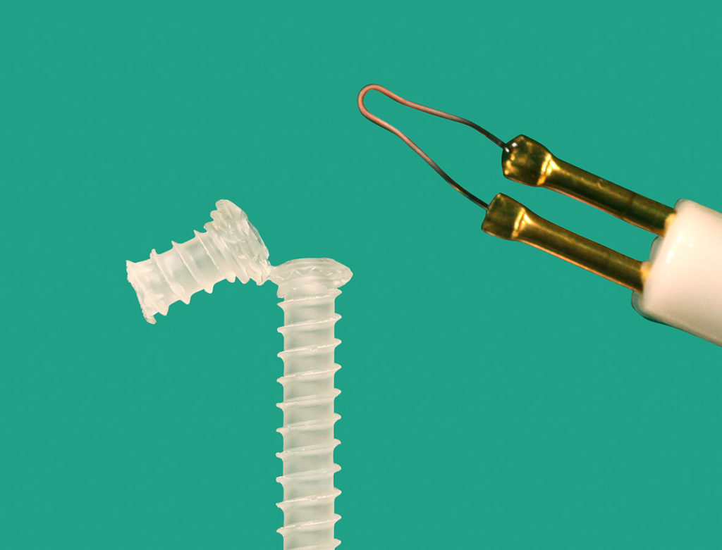 Resorbable screw cut with a hot loop cautery.