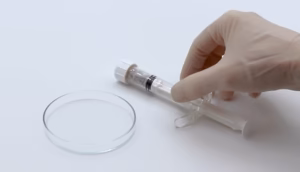 Inion BioRestore™ synthetic bone graft substitute morsels in a syringe prior to preparation and implantation.